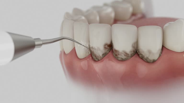 Trusted Invisalign Clear Aligners service in Elmo, TX - Dentist Open Now